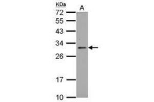 Image no. 1 for anti-TP53 induced glycolysis regulatory phosphatase (TIGAR) (AA 1-270) antibody (ABIN1497017) (TIGAR anticorps  (AA 1-270))