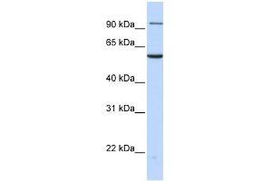 Transportin 2 antibody used at 1 ug/ml to detect target protein. (TNPO2 anticorps)