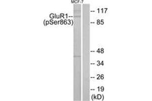 Western blot analysis of extracts from MCF-7 cells, using GluR1 (Phospho-Ser863) Antibody. (Glutamate Receptor 1 anticorps  (pSer863))