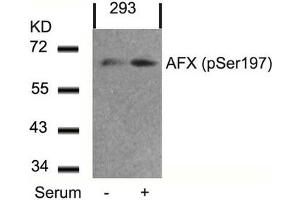 Western blot analysis of extracts from 293 cells untreated or treated with serum using AFX(Phospho-Ser197) Antibody. (FOXO4 anticorps  (pSer197))