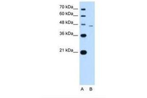 Image no. 1 for anti-SMAD, Mothers Against DPP Homolog 7 (SMAD7) (N-Term) antibody (ABIN324250) (SMAD7 anticorps  (N-Term))