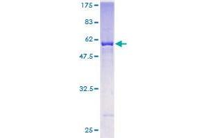 Image no. 1 for Aldo-Keto Reductase Family 7, Member A3 (Aflatoxin Aldehyde Reductase) (AKR7A3) (AA 1-331) protein (GST tag) (ABIN1344776)