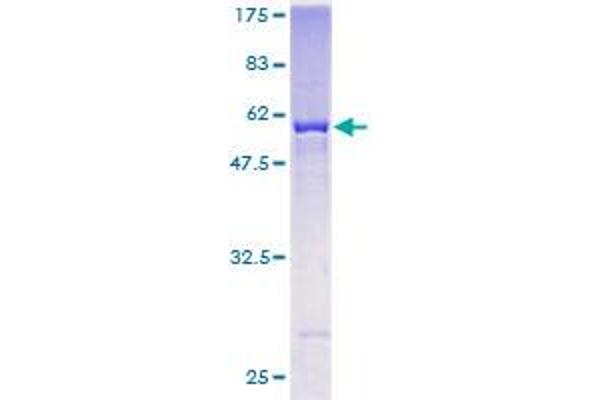 AKR7A3 Protein (AA 1-331) (GST tag)
