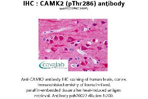 Image no. 1 for anti-Calcium/calmodulin-Dependent Protein Kinase II beta (CAMK2B) (pThr286) antibody (ABIN1732578) (CAMK2B anticorps  (pThr286))