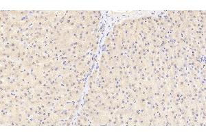 Detection of ACO1 in Human Liver Tissue using Polyclonal Antibody to Aconitase 1 (ACO1)