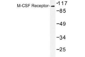 Image no. 1 for anti-Colony Stimulating Factor 1 Receptor (CSF1R) antibody (ABIN317880) (CSF1R anticorps)