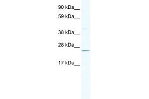 WB Suggested Anti-DNAJC17 Antibody Titration:  2. (DNAJC17 anticorps  (N-Term))
