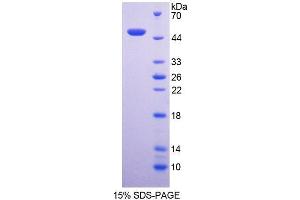 SDS-PAGE analysis of Human NCF1 Protein. (NCF1 Protéine)