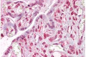 Anti-MLX antibody IHC staining of human placenta. (MLX anticorps  (AA 217-231))