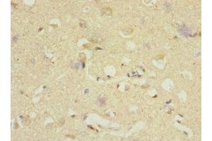 Immunohistochemistry of paraffin-embedded human brain tissue using ABIN7150518 at dilution of 1:100 (DNAJB2 anticorps  (AA 215-324))
