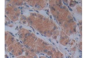 Detection of FBN1 in Human Stomach Tissue using Polyclonal Antibody to Fibrillin 1 (FBN1)