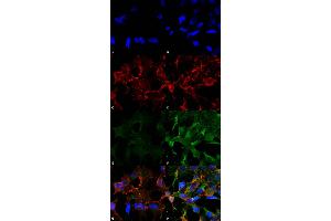 Immunocytochemistry/Immunofluorescence analysis using Mouse Anti-Acrolein Monoclonal Antibody, Clone 2H2 . (Acrolein anticorps  (APC))