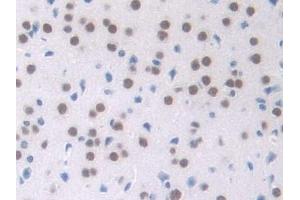 Detection of NPM1 in Mouse Cerebrum Tissue using Polyclonal Antibody to Nucleophosmin 1 (NPM1)