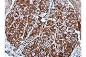 IHC-P Image CRHSP-24 antibody [N1C3] detects CRHSP-24 protein at cytoplasm in mouse prostate by immunohistochemical analysis. (CARHSP1 anticorps)