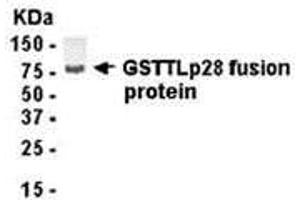 Western Blotting (WB) image for anti-Glutathione S-Transferase omega 1 (GSTO1) (AA 1-241) antibody (ABIN2468060) (GSTO1 anticorps  (AA 1-241))