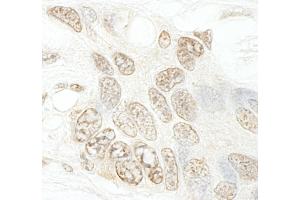 Immunohistochemistry (IHC) image for anti-SET Domain Containing 1B (SETD1B) (AA 350-400) antibody (ABIN7448602)