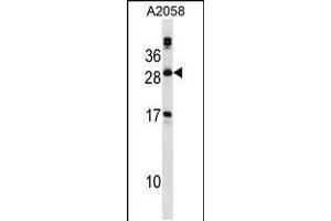 Western blot analysis in A2058 cell line lysates (35ug/lane). (PLA2G12A anticorps  (AA 55-83))