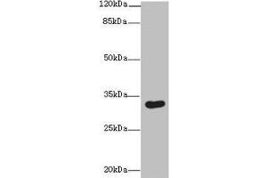 Western blot All lanes: ASB8 antibody at 1 μg/mL + Human placenta tissue Secondary Goat polyclonal to rabbit IgG at 1/10000 dilution Predicted band size: 32 kDa Observed band size: 32 kDa (ASB8 anticorps  (AA 12-288))