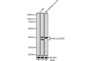 Western blot analysis of extracts of various cell lines, using PD-L1/CD274 antibody (ABIN6129976, ABIN6138153, ABIN6138154 and ABIN6215142) at 1:500 dilution. (PD-L1 anticorps  (AA 19-238))