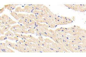 Detection of LTA4H in Mouse Cardiac Muscle Tissue using Polyclonal Antibody to Leukotriene A4 Hydrolase (LTA4H)