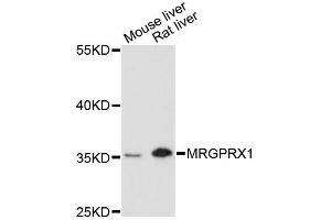 Western blot analysis of extracts of various cell lines, using MRGPRX1 antibody (ABIN6293323) at 1:3000 dilution.