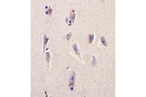 Immunohistochemical analysis of paraffin-embedded H. (Dihydrofolate Reductase anticorps  (N-Term))