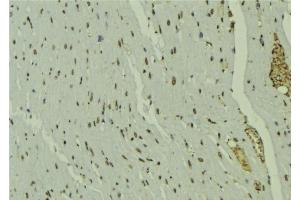 ABIN6277684 at 1/100 staining Mouse muscle tissue by IHC-P. (PPARD anticorps  (C-Term))