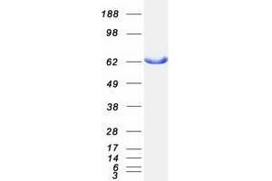 Validation with Western Blot