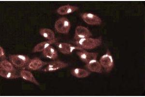 Immunofluorescence staining of HeLa cells (Human cervical epitheloid carcinoma, ATCC CCL-2.