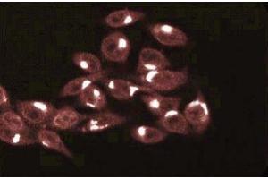 Immunofluorescence staining of HeLa cells (Human cervical epitheloid carcinoma, ATCC CCL-2. (TRADD anticorps  (AA 163-312))