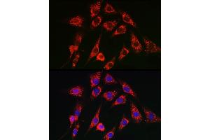 Immunofluorescence analysis of C6 cells using SERC/ Rabbit pAb (ABIN3021429, ABIN3021430, ABIN3021431 and ABIN6215028) at dilution of 1:100 (40x lens).