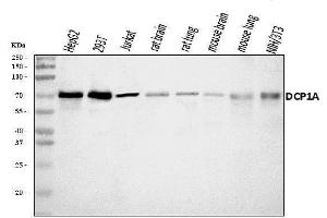 Western blot analysis of DCP1A using anti-DCP1A antibody (ABIN7601317).