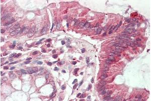 ABIN1781990 (5µg/ml) staining of paraffin embedded Human Colon.