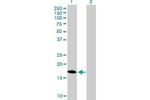 Western Blot analysis of DUX3 expression in transfected 293T cell line by DUX3 MaxPab polyclonal antibody. (DUX3 anticorps  (AA 1-170))