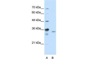 Western Blotting (WB) image for anti-Exosome Component 3 (EXOSC3) antibody (ABIN2462262) (EXOSC3 anticorps)