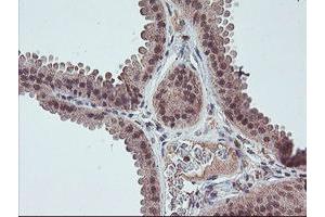 Image no. 4 for anti-Fragile X Mental Retardation 1 (FMR1) (AA 26-279) antibody (ABIN1491292)