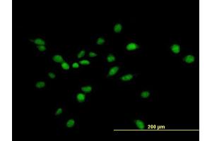 Immunofluorescence of purified MaxPab antibody to NUAK1 on HeLa cell. (NUAK1 anticorps  (AA 1-661))