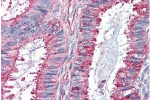 Human Uterus (formalin-fixed, paraffin-embedded) stained with GPR27 antibody ABIN410770 followed by biotinylated goat anti-rabbit IgG secondary antibody ABIN481713, alkaline phosphatase-streptavidin and chromogen. (GPR27 anticorps  (Internal Region))