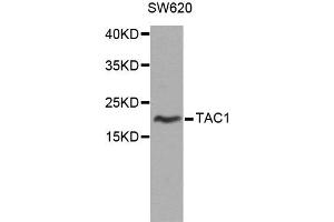 Western blot analysis of extracts of SW620 cells, using TAC1 antibody. (TAC1 anticorps)
