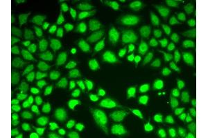 Immunofluorescence analysis of A549 cells using KDM1A antibody. (LSD1 anticorps)