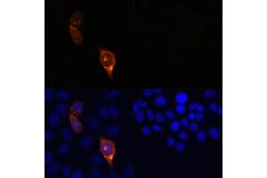 Immunofluorescence analysis of HeLa cells transfected with C (upper left) and untreated HeLa cells (upper right) using C Rabbit pAb (red, ABIN7266523) at dilution of 1:100. (CRISPR-Cas9 anticorps)