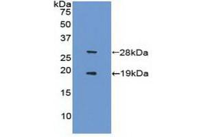 Detection of Recombinant FCN1, Human using Polyclonal Antibody to Sirtuin 1 (SIRT1) (SIRT1 anticorps  (AA 244-498))