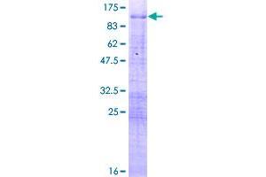 Image no. 1 for Methyl-CpG Binding Domain Protein 1 (MBD1) (AA 1-605) protein (GST tag) (ABIN1310462)