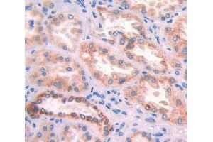 Used in DAB staining on fromalin fixed paraffin- embedded Kidney tissue (APOA4 anticorps  (AA 173-396))