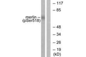 Western blot analysis of extracts from HuvEc cells treated with IFN-alpha 1000U/ml 18h, using Merlin (Phospho-Ser518) Antibody. (Merlin anticorps  (pSer518))