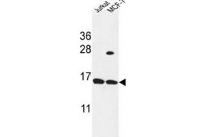 Western Blotting (WB) image for anti-Small Proline Rich Protein 1A (SPRR1A) antibody (ABIN3004230) (SPRR1A anticorps)