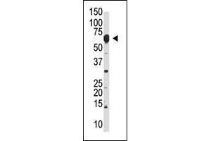 The anti-NYREN18 N-term Pab (ABIN389078 and ABIN2839276) is used in Western blot to detect NYREN18 in mouse liver lysate.