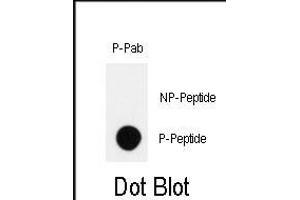 Dot blot analysis of anti-Phospho-HIPK2-p Antibody (ABIN389999 and ABIN2839776) on nitrocellulose membrane. (HIPK2 anticorps  (pTyr361))