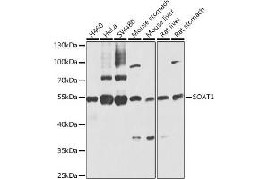 Western blot analysis of extracts of various cell lines, using SO antibody (ABIN6129624, ABIN6148259, ABIN6148260 and ABIN6221917) at 1:1000 dilution. (SOAT1 anticorps  (AA 1-130))