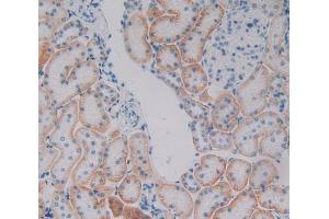 Used in DAB staining on fromalin fixed paraffin- embedded kidney tissue